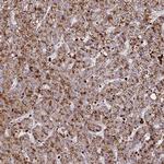 SUSD3 Polyclonal Antibody