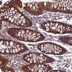 HECA Polyclonal Antibody