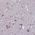 KCNE1L Antibody in Immunohistochemistry (Paraffin) (IHC (P))