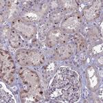 TMEM263 Polyclonal Antibody