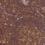 STOML1 Antibody in Immunohistochemistry (Paraffin) (IHC (P))