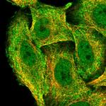 ZNF646 Polyclonal Antibody