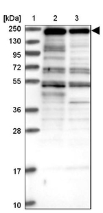 ZNF646 Antibody in Western Blot (WB)