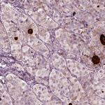 MIA Antibody in Immunohistochemistry (IHC)