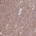 TMEM138 Antibody in Immunohistochemistry (Paraffin) (IHC (P))