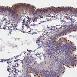 TMEM138 Antibody in Immunohistochemistry (Paraffin) (IHC (P))