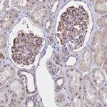 TMEM138 Antibody in Immunohistochemistry (Paraffin) (IHC (P))