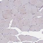 TMEM138 Antibody in Immunohistochemistry (Paraffin) (IHC (P))