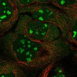 INTS4 Polyclonal Antibody