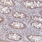 INTS4 Antibody in Immunohistochemistry (Paraffin) (IHC (P))