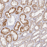 INTS4 Antibody in Immunohistochemistry (Paraffin) (IHC (P))
