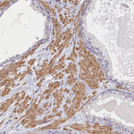 INTS4 Antibody in Immunohistochemistry (Paraffin) (IHC (P))