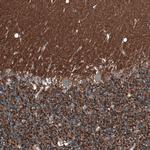 SCD5 Antibody in Immunohistochemistry (Paraffin) (IHC (P))