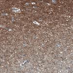 SCD5 Antibody in Immunohistochemistry (Paraffin) (IHC (P))