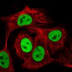 SBNO1 Polyclonal Antibody