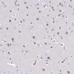 SBNO1 Antibody in Immunohistochemistry (Paraffin) (IHC (P))