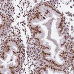 SBNO1 Antibody in Immunohistochemistry (Paraffin) (IHC (P))