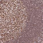 SBNO1 Antibody in Immunohistochemistry (Paraffin) (IHC (P))
