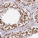 SBNO1 Antibody in Immunohistochemistry (Paraffin) (IHC (P))