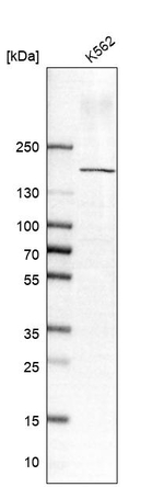 SBNO1 Antibody in Western Blot (WB)