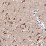 Seipin Polyclonal Antibody