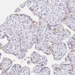 VGLL1 Polyclonal Antibody