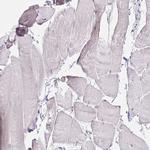 VGLL1 Antibody in Immunohistochemistry (Paraffin) (IHC (P))