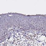 CLRN2 Antibody in Immunohistochemistry (Paraffin) (IHC (P))