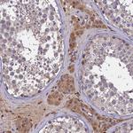 CLRN2 Antibody in Immunohistochemistry (Paraffin) (IHC (P))