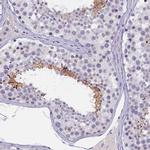 KIAA1683 Antibody in Immunohistochemistry (IHC)