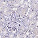 KIAA1683 Antibody in Immunohistochemistry (IHC)