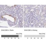 KIAA1683 Antibody