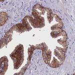 COL19A1 Antibody in Immunohistochemistry (Paraffin) (IHC (P))