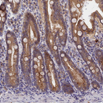 COL19A1 Antibody in Immunohistochemistry (Paraffin) (IHC (P))