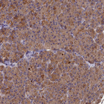 COL19A1 Antibody in Immunohistochemistry (Paraffin) (IHC (P))
