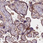 NAIP Polyclonal Antibody