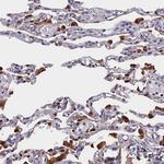 CRIP1 Antibody in Immunohistochemistry (Paraffin) (IHC (P))