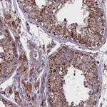 GLRX5 Polyclonal Antibody