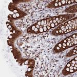 ZNF816 Polyclonal Antibody