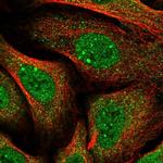 HGH1 Polyclonal Antibody