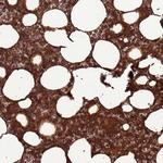 HGH1 Antibody in Immunohistochemistry (IHC)