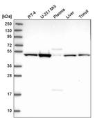 HGH1 Antibody in Western Blot (WB)