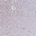 UNC80 Antibody in Immunohistochemistry (IHC)