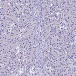 UNC80 Antibody in Immunohistochemistry (IHC)