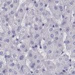SEMG1 Antibody in Immunohistochemistry (IHC)