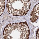 CT47 Antibody in Immunohistochemistry (IHC)