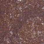 GMIP Antibody in Immunohistochemistry (Paraffin) (IHC (P))