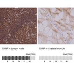 GMIP Antibody in Immunohistochemistry (IHC)