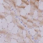 GMIP Antibody in Immunohistochemistry (IHC)