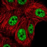 AKAP8L Polyclonal Antibody